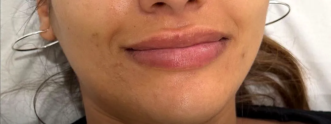 Signature Lips, after